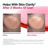 image:imageAnua 2 BHA  10 Niacinamide Skin Booster Duo  10 Niacinamide  4 Tranexamic Acid Serum for Dull Skin Gentle Exfoliating Toner Salicylic Acid for pore Control Korean Skincare set