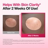 image:imageAnua Spot Eraser Duo Niacinamide 10  TXA 4 Serum amp Triple Acid Spot Care Microdart Patch