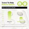 image:imageANUA UltraThin Spot Cover Patch Invisible Hydrocolloid Acne Patch for Face Cute Pimple Patches for Sensitive Skin Korean Skincare 75 Counts Pack of 275 Count Pack of 1