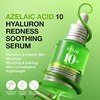 image:imageAnua Azelaic Acid Soothing Duo Azelaic Acid Hyaluron Redness Soothing Serum amp CICA Skin Soothing Moisturizer Lightweight amp Hydrating Serum with Moisturizer Korean Skincare