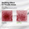 image:imageANUA Azelaic Acid CICA Skin Soothing Moisturizer Lightweight amp Redness Relief For Acne Prone Skin Fragrance Free Korean Skincare 338 fl oz
