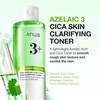 image:imageAnua Azelaic Total Soothing Trio Azelaic Acid amp Cica Lightweight amp Hydrating Korean Skincare Set